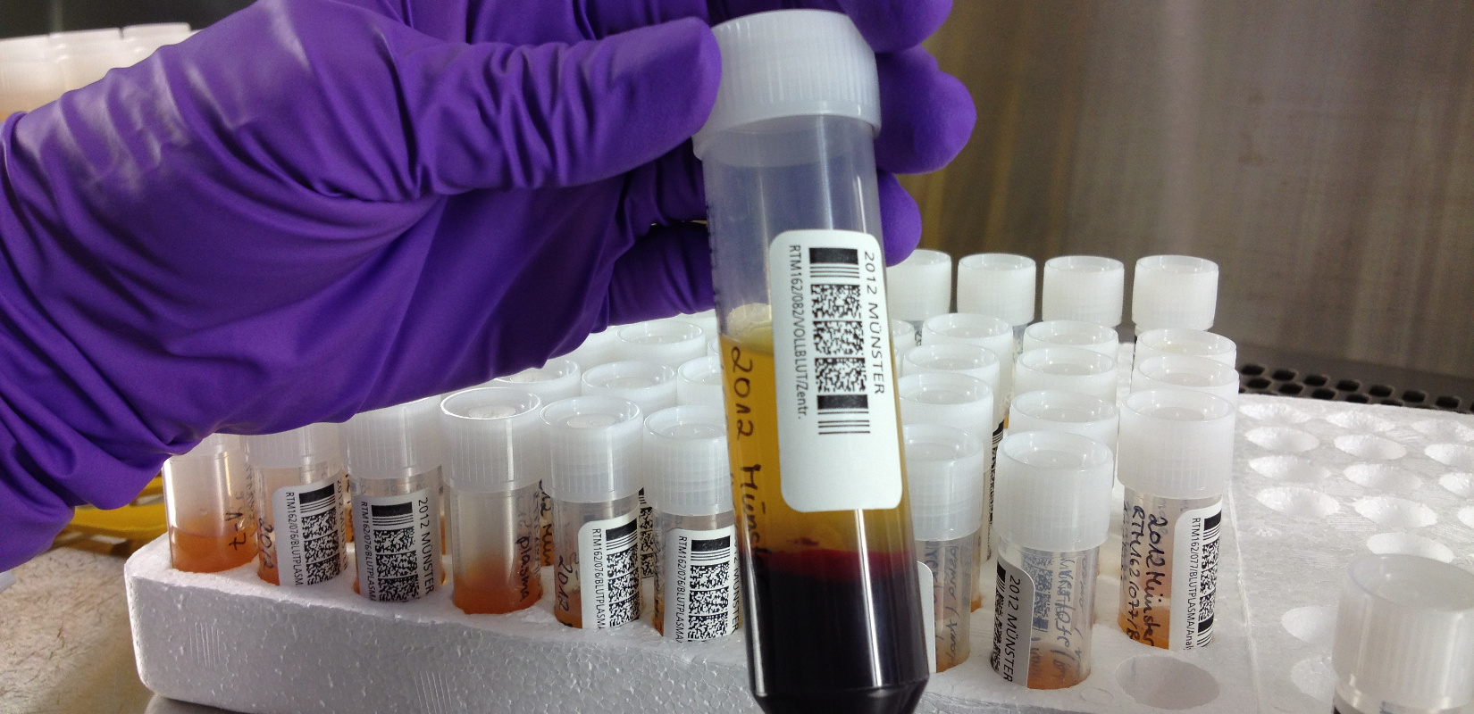 Sample of whole blood