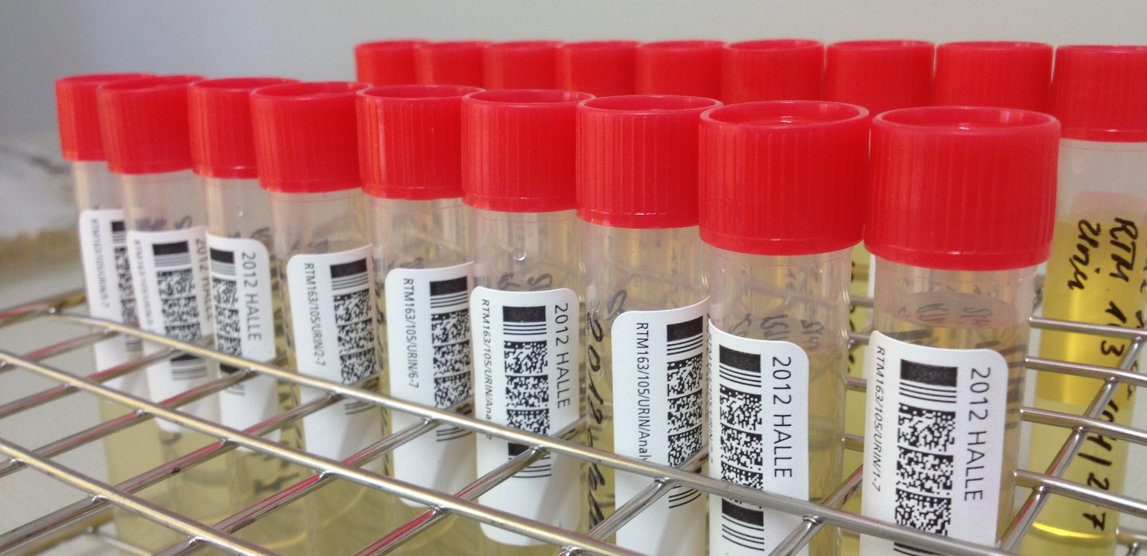24h-sampling urine samples